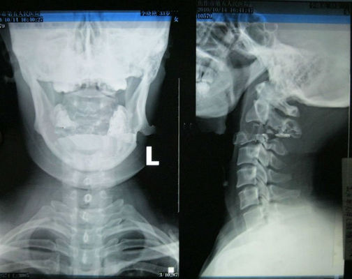 ভালো দাম লেজার প্রিন্টারের জন্য হাই শার্পনেস পরিধানযোগ্য কোনিডা মেডিকেল ইমেজিং এক্স্রে পেপার অনলাইন