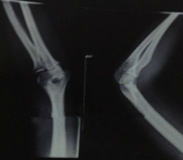 ভালো দাম লেজার প্রিন্টার্স কেএনডি-কে জন্য জলরোধী এক্স রে ডায়াগনস্টিক ইমেজিং মেডিকেল পেপার অনলাইন