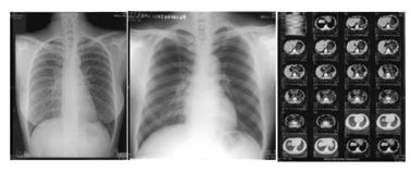 ভালো দাম 14in X 17 ইঞ্চি থার্মাল প্রিন্টার ফিল্ম অনলাইন
