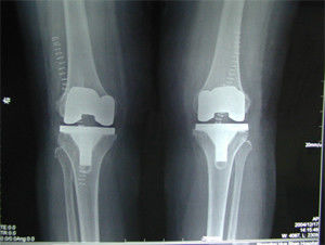 ভালো দাম 14 * 17 ইঞ্চি আগাফা উচ্চমানের ড্রাই ডিজিটাল এক্স রে ফিল্ম অনলাইন