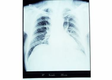 Good price Dry X Ray Medical Diagnostic Imaging Radiology For AGFA / FUJI 2000 অনলাইন