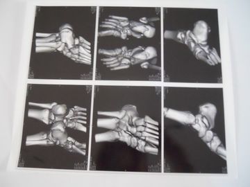 ভালো দাম এজিএফএ 5300, 5302, 5500 এ এক্স রে পরীক্ষার জন্য মেডিকেল ড্রাই ড্রাই ইমেজিং ফিল্ম অনলাইন