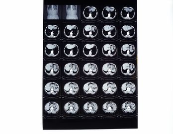 Good price তাপীয় প্রিন্টারের জন্য কম কুয়াশক 10in * 14in কোনিডা মেডিকেল ড্রাই ড্রাই ফিল্ম, ফুজি 3000, 2000, 1000 অনলাইন